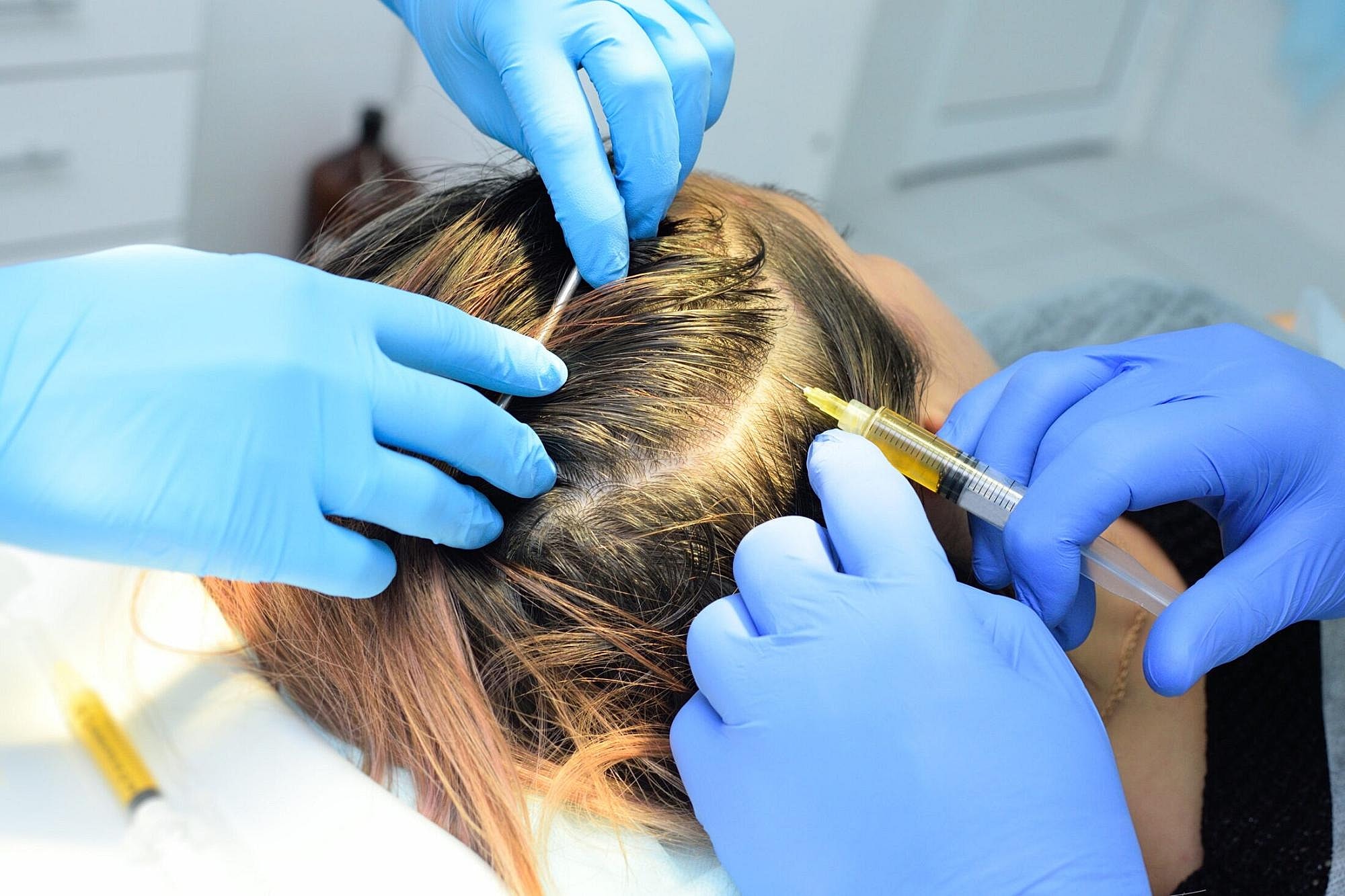 Hair treatment procedure with gloved hands.