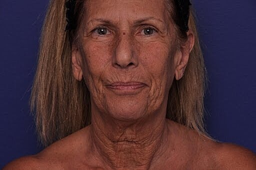 Older woman with ponytail against blue background.