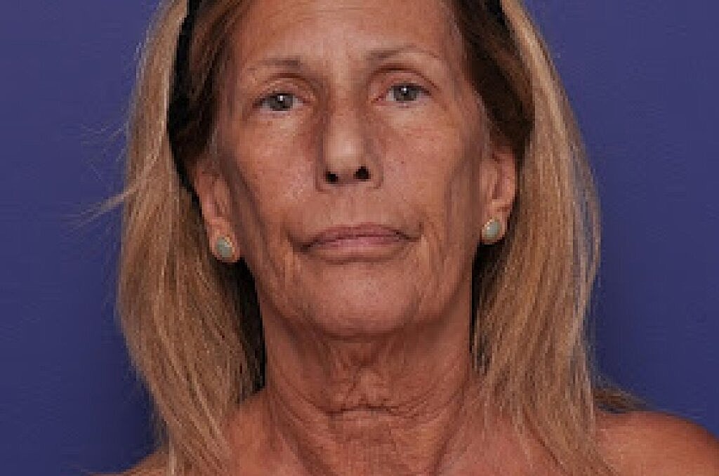 Portrait of a woman with blonde hair.