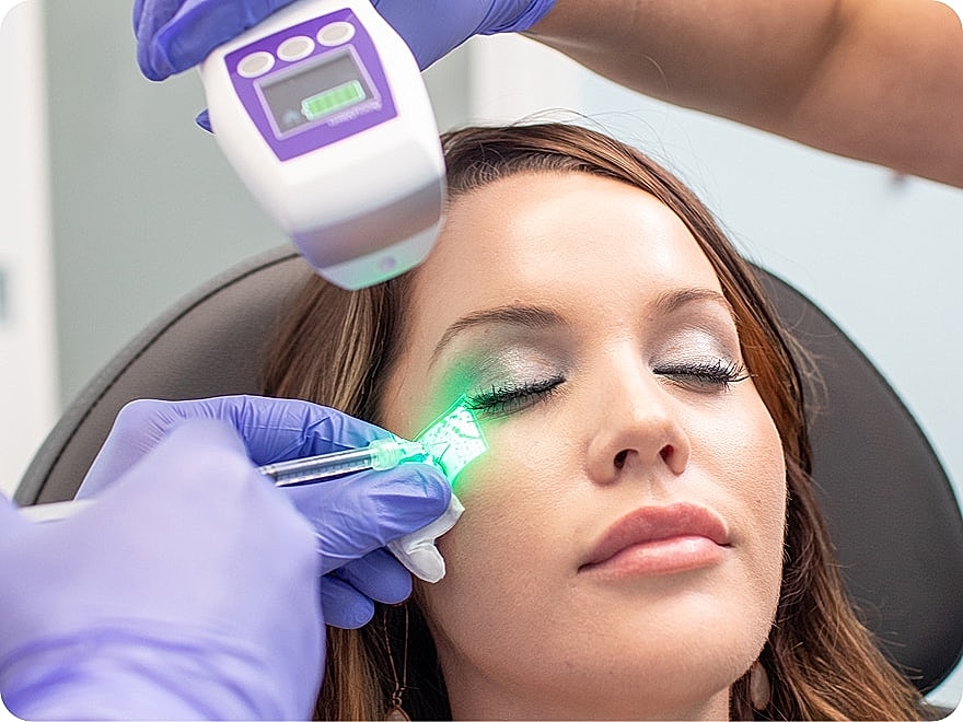 Woman receiving laser treatment near eye.